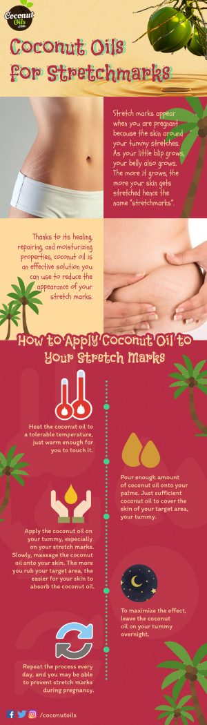 Coconut Oil for Stretch Marks During Pregnancy